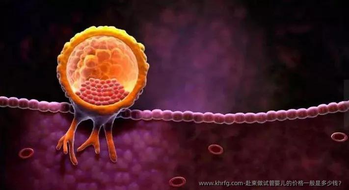 赴柬做试管婴儿的价格一般是多少钱？