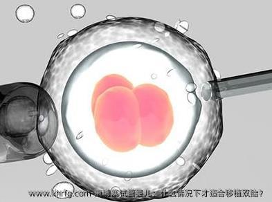 柬埔寨试管婴儿：什么情况下才适合移植双胎？