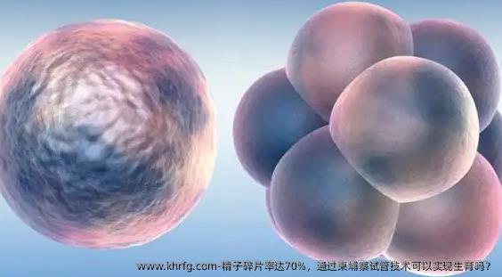 精子碎片率达70%，通过柬埔寨试管技术可以实现生育吗？