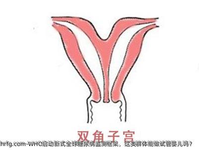 WHO启动新式全球糖尿病监测框架，这类群体能做试管婴儿吗？