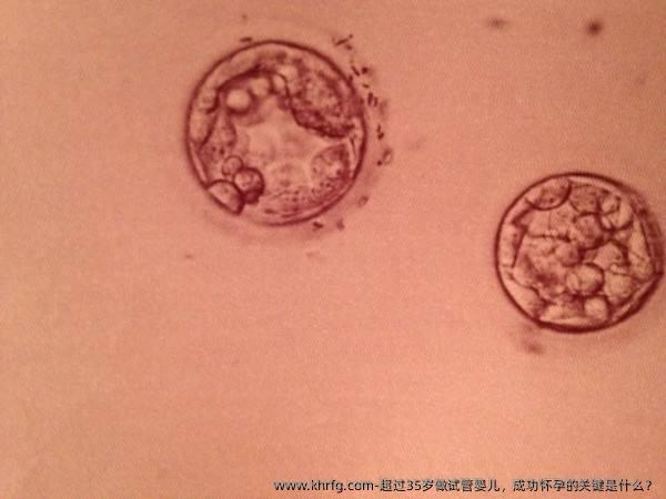 超过35岁做试管婴儿，成功怀孕的关键是什么？