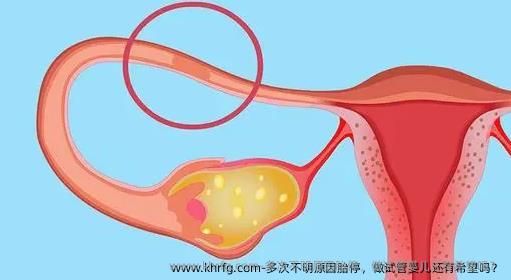 多次不明原因胎停，做试管婴儿还有希望吗？