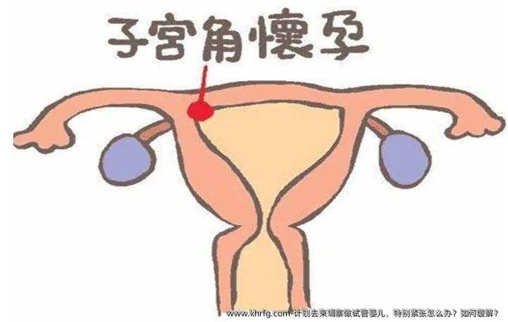 计划去柬埔寨做试管婴儿，特别紧张怎么办？如何缓解？