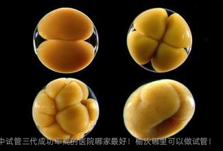 晋中试管三代成功率高的医院哪家较好！榆次哪里可以做试管！