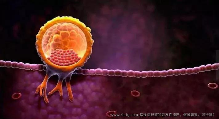 易栓症导致的复发性流产，做试管婴儿可行吗？