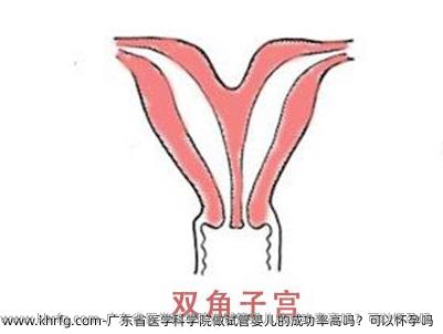 广东省医学科学院做试管婴儿的成功率高吗？可以怀孕吗