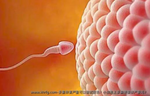 多囊卵巢严重可以做试管吗？小孩患上多囊卵巢很严重吗？