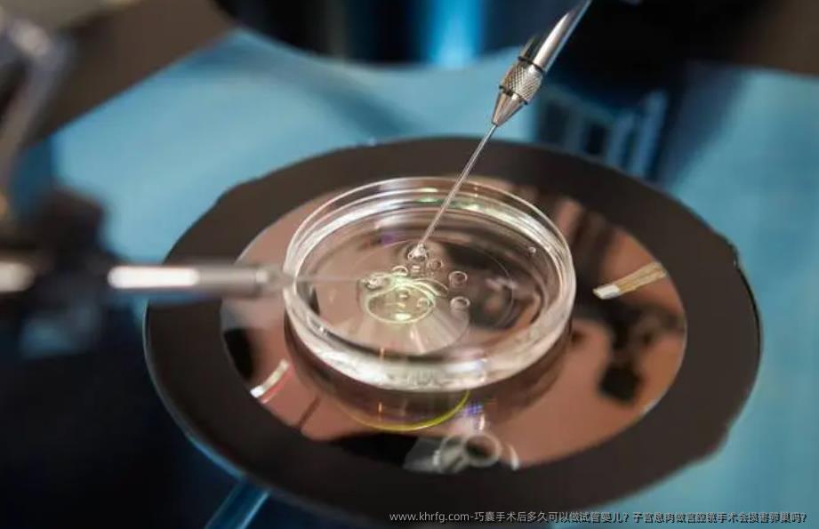 巧囊手术后多久可以做试管婴儿？子宫息肉做宫腔镜手术会损害卵巢吗？