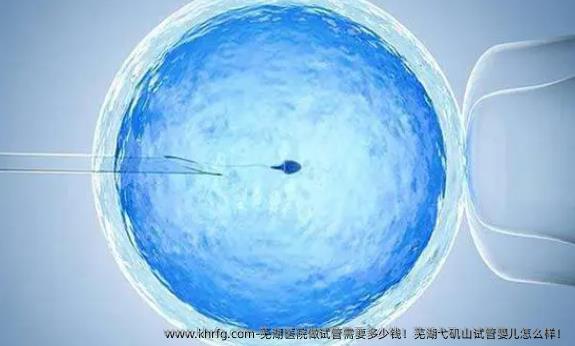 芜湖医院做试管需要多少钱！芜湖弋矶山试管婴儿怎么样！