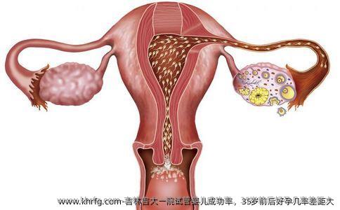吉林吉大一院试管婴儿成功率，35岁前后好孕几率差距大
