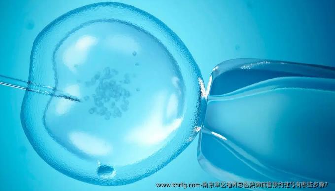 南京军区福州总医院做试管预约挂号有哪些步骤？