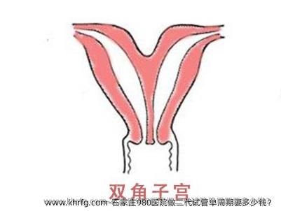 石家庄980医院做二代试管单周期要多少钱？