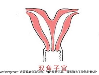 试管婴儿备孕知识：治疗男性不育，哪些情况下需要取精呢?