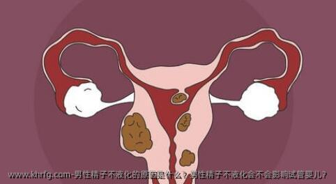 男性精子不液化的原因是什么？男性精子不液化会不会影响试管婴儿？