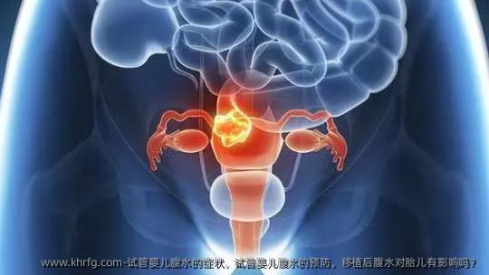 试管婴儿腹水的症状，试管婴儿腹水的预防，移植后腹水对胎儿有影响吗？