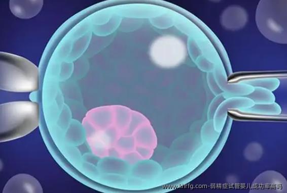 弱精症试管婴儿成功率高吗