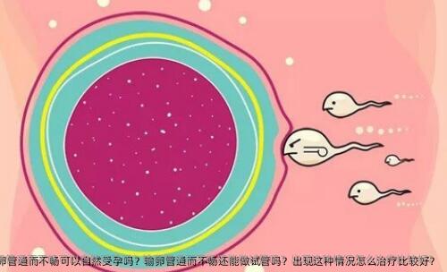 输卵管通而不畅可以自然受孕吗？输卵管通而不畅还能做试管吗？出现这种情况怎么治疗比较好？