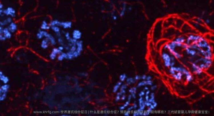 世界唐氏综合征日 | 什么是唐氏综合征？预防唐氏综合征的手段有哪些？三代试管婴儿孕育健康宝宝！