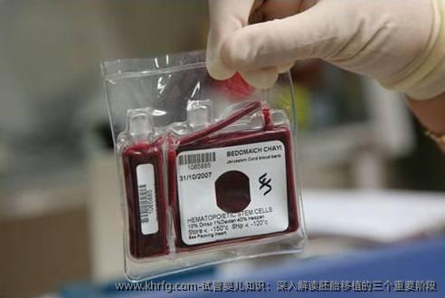 试管婴儿知识：深入解读胚胎移植的三个重要阶段