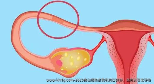 2025佛山哪些试管机构口碑好，含患者真实评价