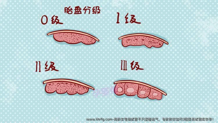 高龄女性做试管不只是碰运气，专家教你如何3招提高试管成功率！