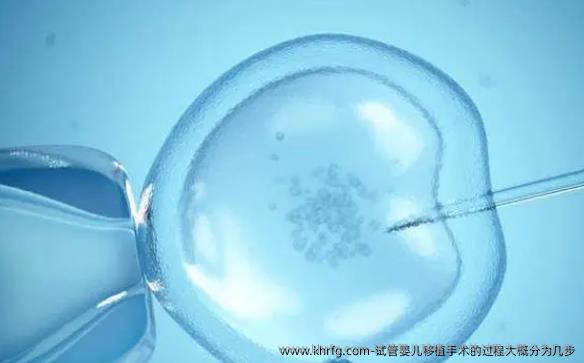 试管婴儿移植手术的过程大概分为几步