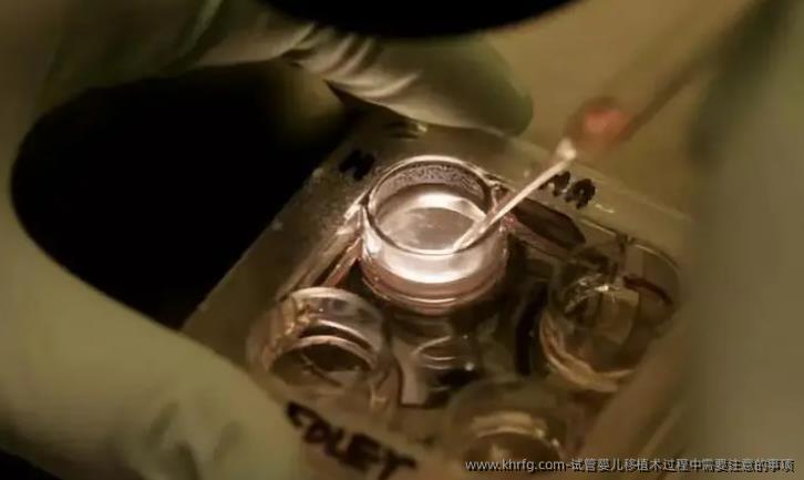 试管婴儿移植术过程中需要注意的事项