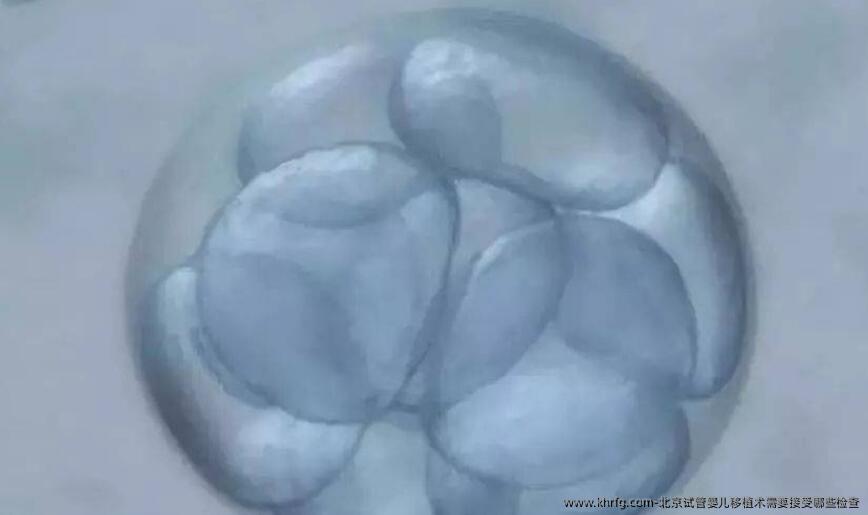 北京试管婴儿移植术需要接受哪些检查