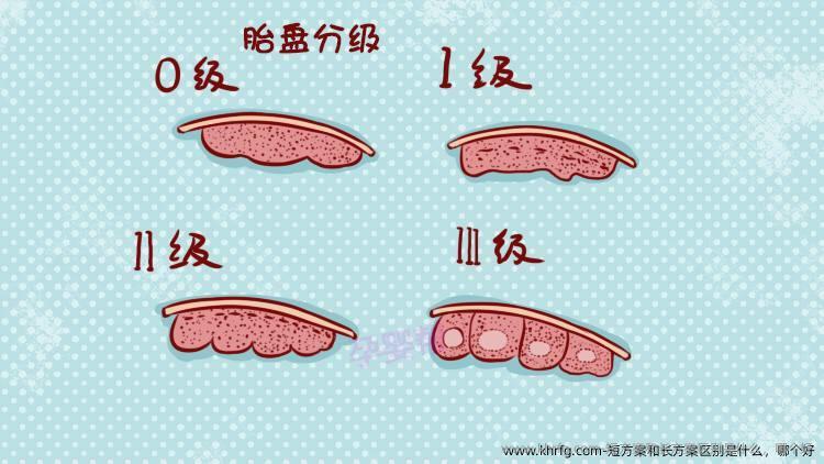 短方案和长方案区别是什么，哪个好