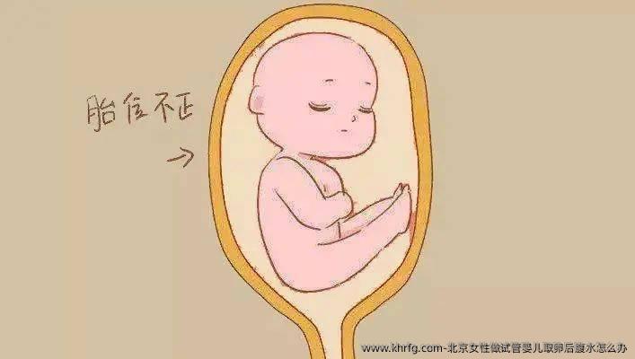 北京女性做试管婴儿卵泡取出后腹水怎么办
