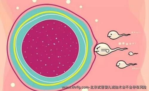 北京试管婴儿减胎术会不会存在风险