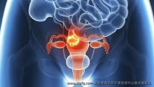 是否患有不孕不育症就可以做试管婴儿