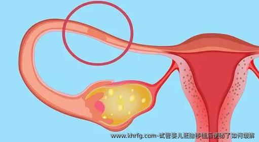 试管婴儿胚胎移植后便秘了如何缓解