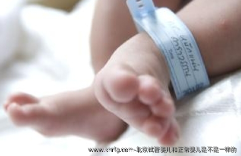 北京试管婴儿和正常婴儿是不是一样的