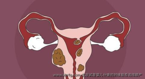 北京试管婴儿分娩的时候能否选择顺产
