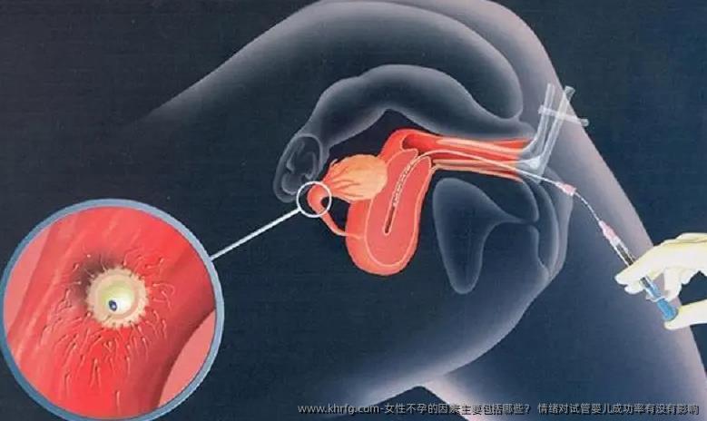 女性不孕的因素主要包括哪些？ 情绪对试管婴儿成功率有没有影响