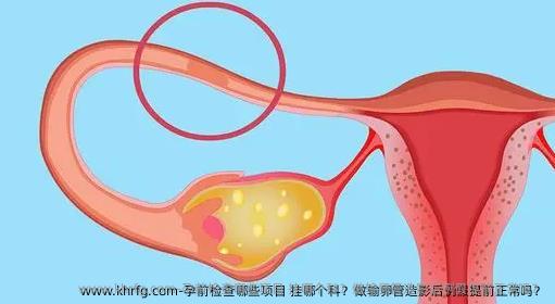 孕前检查哪些项目 挂哪个科？做输卵管造影后例假提前正常吗？
