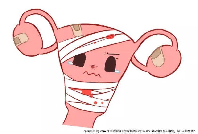 引起试管婴儿失败的原因是什么呢？老公检查出无精症，吃什么能生精？