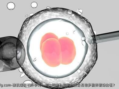腺肌症影响怀孕吗？要如何治？怎样判断是否患多囊卵巢综合征？