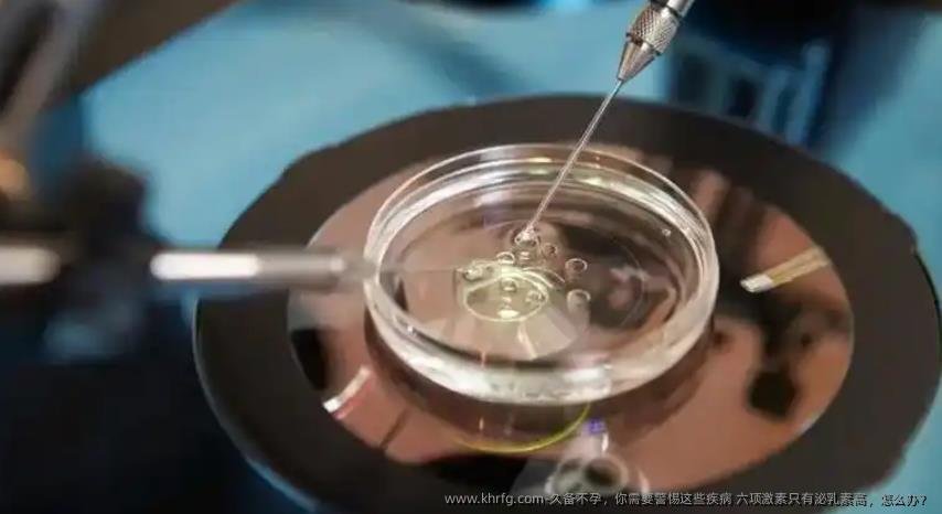久备不孕，你需要警惕这些疾病 六项激素只有泌乳素高，怎么办？