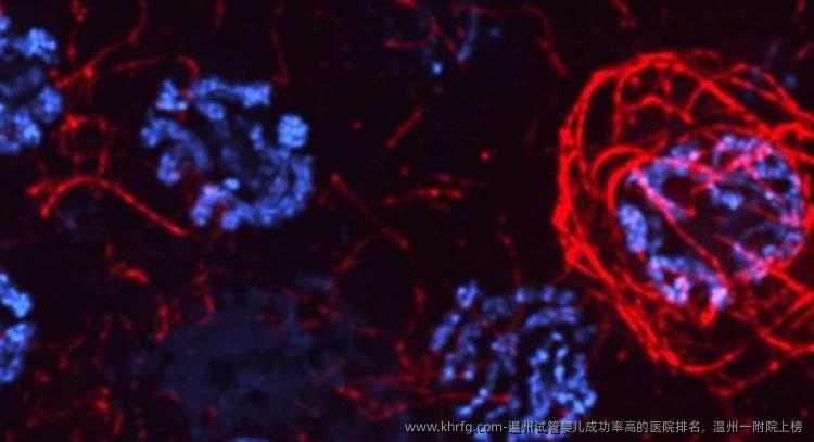 温州试管婴儿成功率高的医院排名，温州一附院上榜