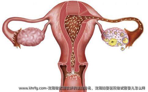 沈阳做试管较好的医院排名，沈阳妇婴医院做试管婴儿怎么样