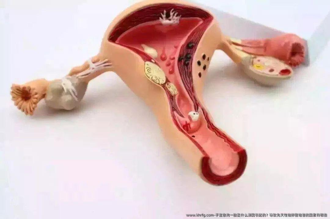 子宫息肉一般是什么原因引起的？导致先天性输卵管堵塞的因素有哪些