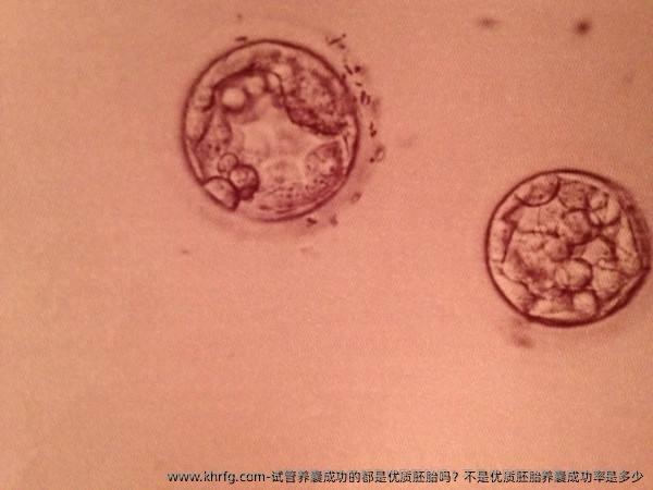 试管养囊成功的都是优质胚胎吗？不是优质胚胎养囊成功率是多少