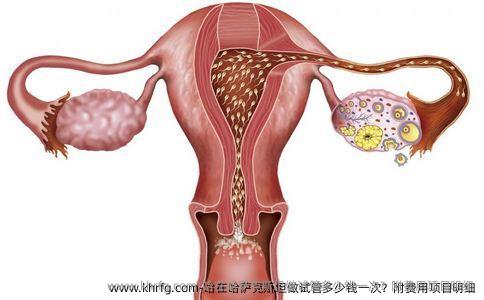 哈在哈萨克斯坦做试管多少钱一次？附费用项目明细