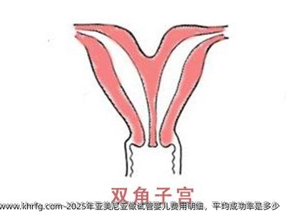 2025年亚美尼亚做试管婴儿费用明细，平均成功率是多少