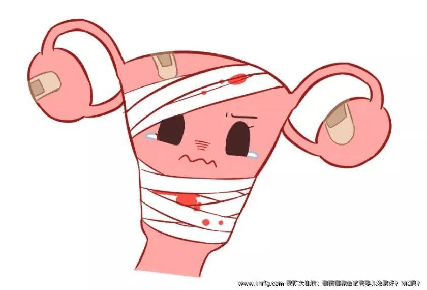 医院大比拼：泰国哪家做试管婴儿效果好？NIC吗？