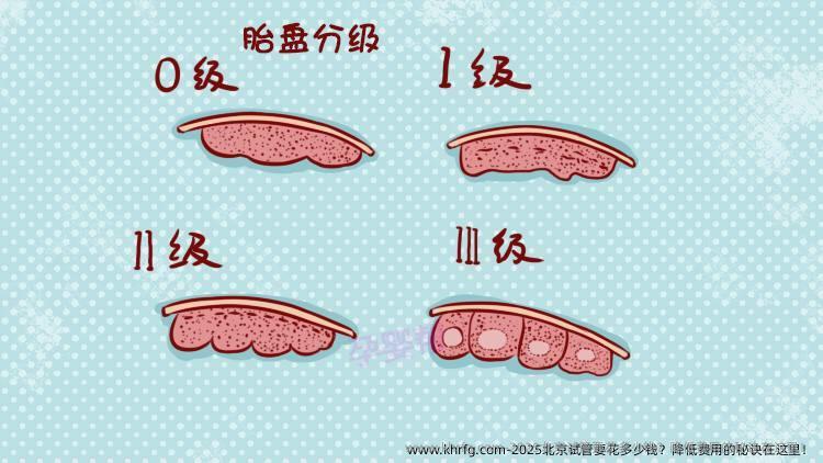 2025北京试管要花多少钱？降低费用的秘诀在这里！