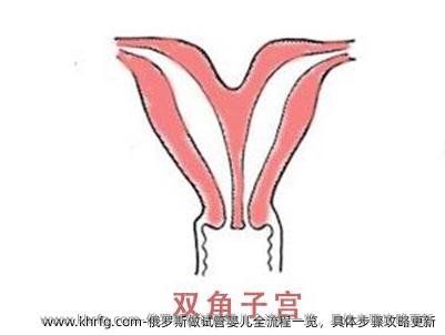 俄罗斯做试管婴儿全流程一览，具体步骤攻略更新