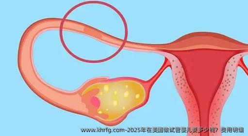 2025年在美国做试管婴儿要多少钱？费用明细